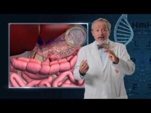 Cómo limpiar el páncreas para aumentar la producción de insulina