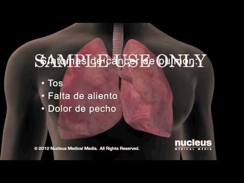 Síntomas del Cáncer: ¿Cuáles Son?